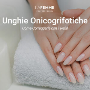 Unghie onicogrifotiche